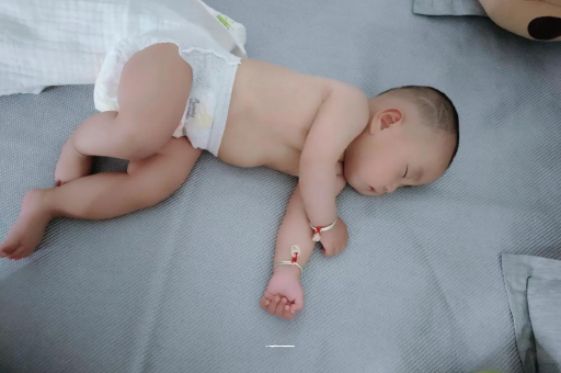 吴忠宝宝褶皱处擦粉还是油